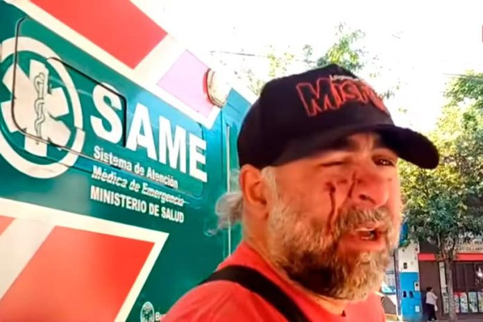 222 cAMARÒGRAFO GOLPEADO POLICIA
